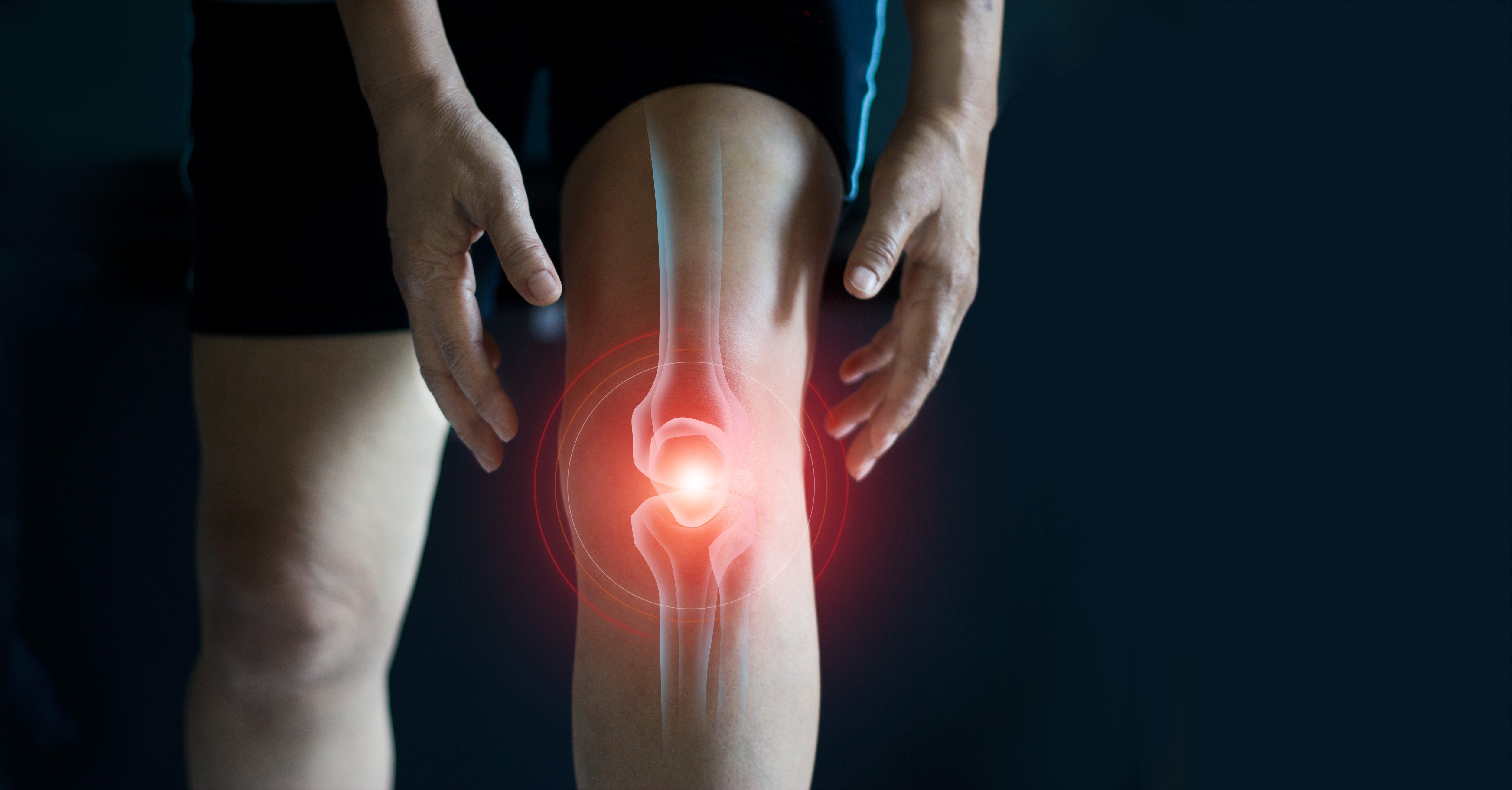 Understanding and Conquering Knee Pain: Causes, Treatments, and Empowe – Motive Health